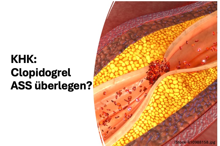 Featured image for “Clopidogrel könnte Herz und Gefäße besser als Aspirin schützen”