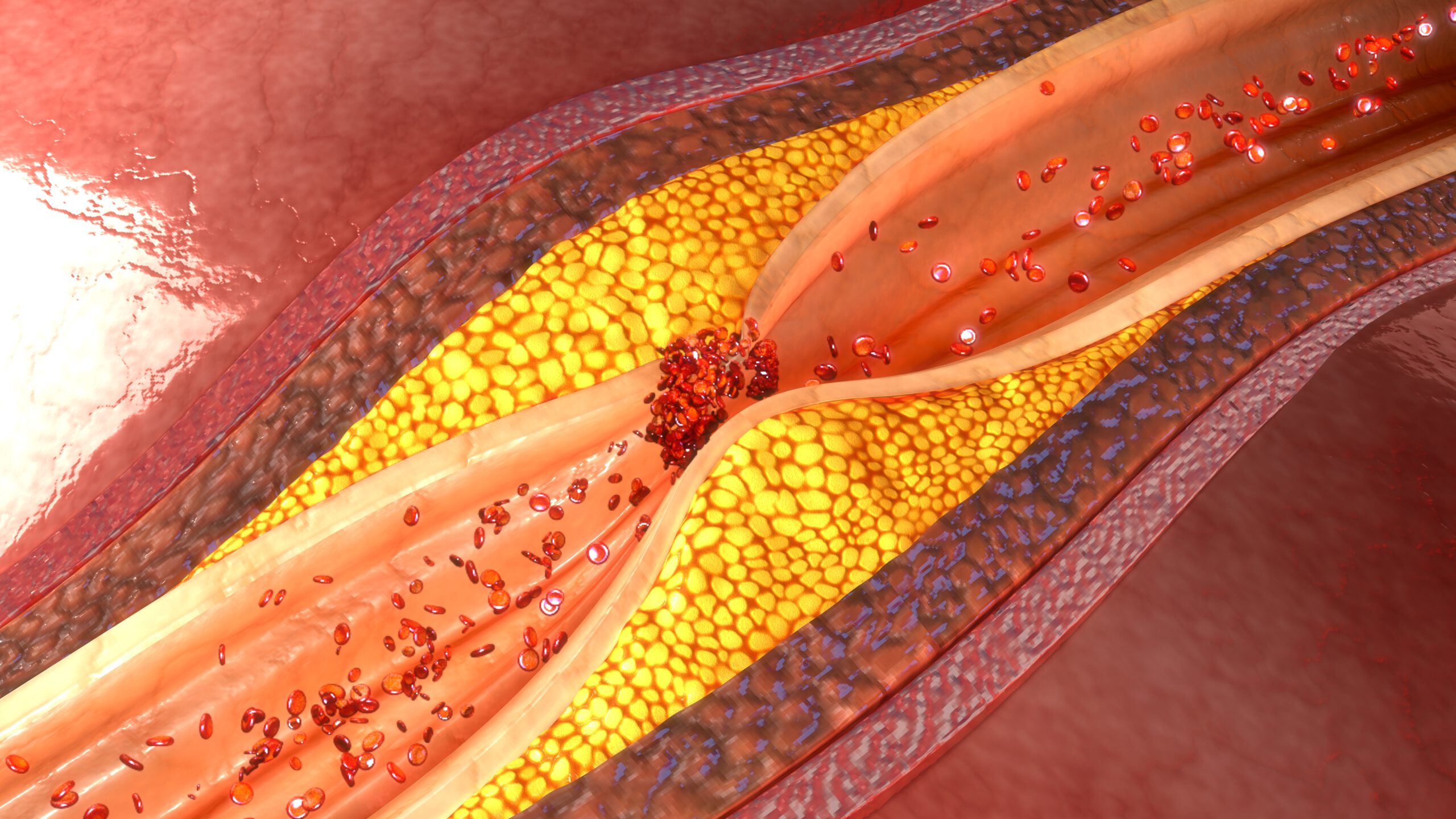 Featured image for “LDL-Cholesterin: Mehr als nur ein Risikofaktor”